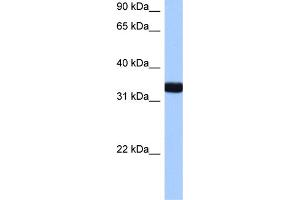 WB Suggested Anti-GIMAP1 Antibody Titration:  0. (GTPase, IMAP Family Member 1 (GIMAP1) (N-Term) 抗体)