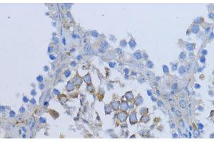 Immunohistochemistry of paraffin-embedded Mouse testis using NRG4 Polyclonal Antibody at dilution of 1:200 (40x lens). (Neuregulin 4 抗体)