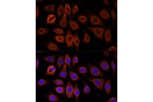 Immunofluorescence analysis of L929 cells using TMEM11 antibody (ABIN7270952) at dilution of 1:100. (TMEM11 抗体  (AA 1-80))