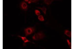 ABIN6275993 staining Hela by IF/ICC. (FZD8 抗体  (N-Term))