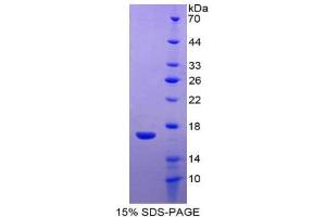 SDS-PAGE (SDS) image for WAP Four-Disulfide Core Domain 5 (WFDC5) (AA 1-123) protein (His tag) (ABIN1981162) (WFDC5 Protein (AA 1-123) (His tag))