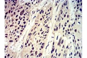 Immunohistochemistry (IHC) image for anti-Eukaryotic Translation Initiation Factor 4E Binding Protein 1 (EIF4EBP1) (pSer65) antibody (ABIN5611114)