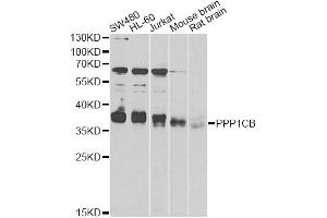 Western blot analysis of extracts of various cell lines, using PPP1CB antibody (ABIN6290761) at 1:1000 dilution. (PPP1CB 抗体)
