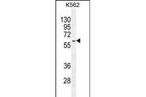 KRT73 Antibody (C-term) (ABIN655195 and ABIN2844811) western blot analysis in K562 cell line lysates (35 μg/lane). (KRT73 抗体  (C-Term))