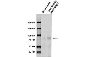 Western blot analysis of Rat kidney tissue lysates showing detection of ENaC protein using Rabbit Anti-ENaC Polyclonal Antibody . (SCNN1A 抗体  (AA 46-68) (Biotin))