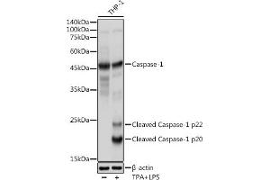 Immunohistochemistry of paraffin-embedded human colon using Caspase-1 Rabbit pAb (ABIN3021170, ABIN3021171, ABIN3021172 and ABIN6214049) at dilution of 1:100 (40x lens). (Caspase 1 抗体  (AA 1-311))