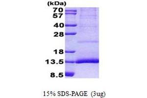 SDS-PAGE (SDS) image for Cystatin 11 (CST11) (AA 26-103) protein (His tag) (ABIN5852992) (CST11 Protein (AA 26-103) (His tag))