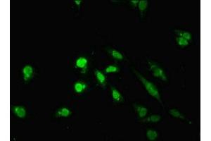 Immunofluorescent analysis of Hela cells using ABIN7172224 at dilution of 1:100 and Alexa Fluor 488-congugated AffiniPure Goat Anti-Rabbit IgG(H+L) (TM2D3 抗体  (AA 31-153))