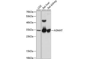 Western blot analysis of extracts of various cell lines, using AGMAT antibody (ABIN6131218, ABIN6136634, ABIN6136635 and ABIN6215786) at 1:1000 dilution. (AGMAT 抗体  (AA 1-352))
