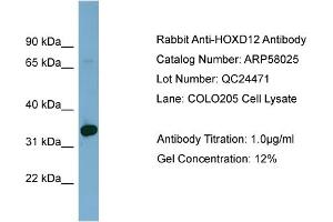 WB Suggested Anti-HOXD12  Antibody Titration: 0. (HOXD12 抗体  (Middle Region))