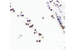Immunohistochemical analysis of CGBP staining in mouse lung formalin fixed paraffin embedded tissue section. (CXXC1 抗体)