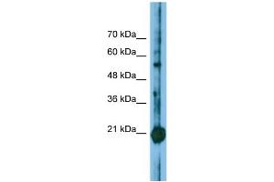 Host: Rabbit Target Name: CBFB Sample Type: Jurkat Whole Cell lysates Antibody Dilution: 1. (CBFB 抗体  (N-Term))