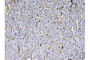 IHC analysis of CD105 using anti-CD105 antibody . (Endoglin 抗体  (AA 27-226))