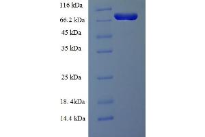 SDS-PAGE (SDS) image for Lymphocyte Cytosolic Protein 1 (LCP1) (AA 2-627) protein (His tag) (ABIN5713598) (LCP1 Protein (AA 2-627) (His tag))