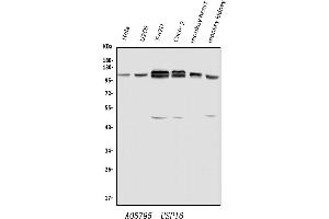 Western blot analysis of USP16 using anti-USP16 antibody (ABIN7602640). (USP16 抗体  (AA 9-823))