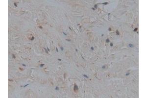 Used in DAB staining on fromalin fixed paraffin-embedded Liver tissue (Apolipoprotein M 抗体  (AA 8-188))