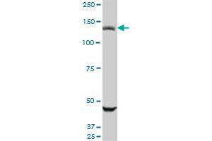 USP45 monoclonal antibody (M01), clone 1H2. (USP45 抗体  (AA 106-196))