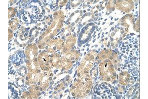 KHK antibody was used for immunohistochemistry at a concentration of 4-8 ug/ml. (Ketohexokinase 抗体)