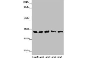 Western blot All lanes: MMACHC antibody at 5. (MMACHC 抗体  (AA 63-282))