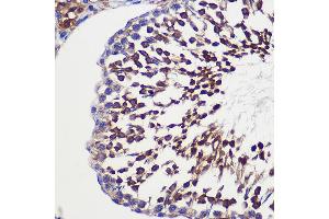 Immunohistochemistry of paraffin-embedded Rat testis using TUBGCP6 Rabbit pAb (ABIN7271055) at dilution of 1:100 (40x lens). (GCP6 抗体  (AA 600-900))