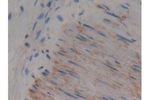 Immunohistochemistry (IHC) image for anti-Adenylyl Cyclase Associated Protein 2 (CAP2) (AA 1-477) antibody (ABIN7443644)