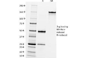 SDS-PAGE Analysis Purified CD10 Mouse Monoclonal Antibody (FR4D11). (MME 抗体)