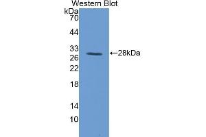 Detection of Recombinant TFR, Pig using Polyclonal Antibody to Transferrin Receptor (TFR) (Transferrin Receptor 抗体  (AA 578-765))