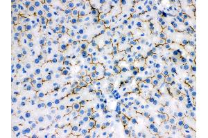 Immunohistochemistry (IHC) image for anti-ATP-Binding Cassette, Sub-Family B (MDR/TAP), Member 11 (ABCB11) (AA 1175-1199), (C-Term) antibody (ABIN3043733)