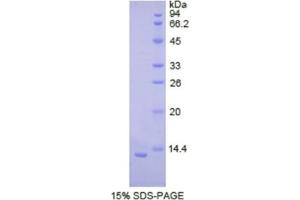 SDS-PAGE analysis of Human Cadherin, Neuronal Protein. (N-Cadherin 蛋白)