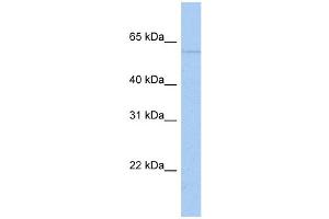 WB Suggested Anti-PAPD4 Antibody Titration:  0. (PAPD4 抗体  (N-Term))
