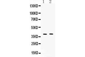 Western blot analysis of MC3 Receptor expression in mouse kidney extract ( Lane 1), and COLO320 whole cell lysates ( Lane 2). (MC3R 抗体  (N-Term))