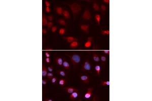 Immunofluorescence analysis of U2OS cells using ATP7B antibody. (ATP7B 抗体)