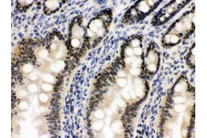 Anti- OGT Picoband antibody,IHC(P) IHC(P): Rat Intestine Tissue (OGT 抗体  (C-Term))