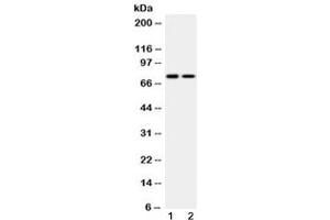 Western blot testing of 1) rat heart and 2) human K562 lysate with KCNQ1 antibody at 0.