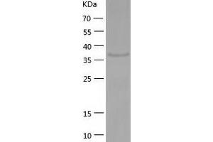 Western Blotting (WB) image for Protein Phosphatase Methylesterase 1 (PPME1) (AA 1-386) protein (His tag) (ABIN7124673) (PPME1 Protein (AA 1-386) (His tag))