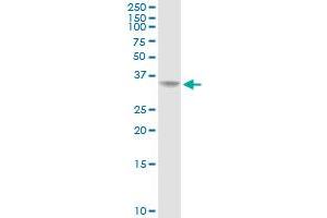 AKR1C2 MaxPab rabbit polyclonal antibody. (AKR1C2 抗体  (AA 1-323))
