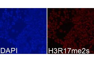 Immunofluorescence analysis of 293T cells using Symmetric DiMethyl-Histone H3-R17 antibody (ABIN3017470, ABIN3017471, ABIN3017472 and ABIN6220102).