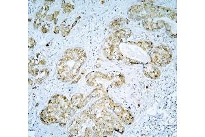 IHC analysis of DARS2 using anti-DARS2 antibody (ABIN6719279).