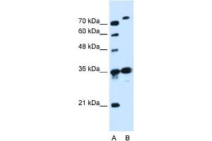WB Suggested Anti-SLC9A7 Antibody Titration:  0. (NHE7 抗体  (N-Term))