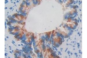 Detection of RNASE3 in Rat Lung Tissue using Polyclonal Antibody to Ribonuclease A3 (RNASE3) (RNASE3 抗体  (AA 33-155))