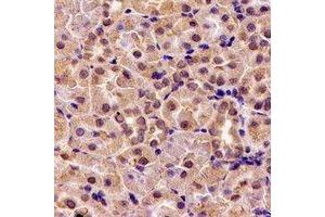Immunohistochemical analysis of HS1BP3 staining in rat kidney formalin fixed paraffin embedded tissue section.