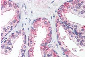 Human Prostate (formalin-fixed, paraffin-embedded) stained with CLDN5 antibody ABIN364455 at 15 ug/ml followed by biotinylated goat anti-rabbit IgG secondary antibody ABIN481713, alkaline phosphatase-streptavidin and chromogen. (Claudin 5 抗体  (C-Term))