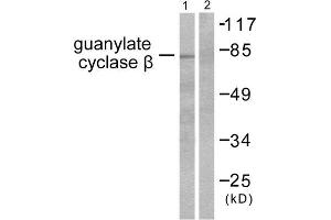 Western Blotting (WB) image for anti-Guanylate Cyclase, beta (GUCYB) (N-Term) antibody (ABIN1848590) (GUCYB 抗体  (N-Term))