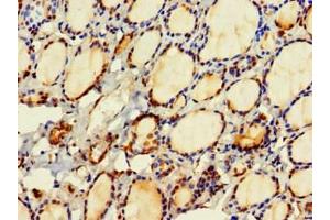 Immunohistochemistry of paraffin-embedded human thyroid tissue using ABIN7154818 at dilution of 1:100 (HDHD2 抗体  (AA 97-249))