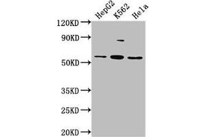 Western Blot Positive WB detected in: HepG2 whole cell lysate, K562 whole cell lysate, Hela whole cell lysate All lanes: ADRA1A antibody at 1:2000 Secondary Goat polyclonal to rabbit IgG at 1/50000 dilution Predicted band size: 52, 53, 48, 51, 33, 38, 36, 41 kDa Observed band size: 52 kDa (alpha 1 Adrenergic Receptor 抗体  (AA 6-22))