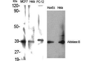 Western Blot (WB) analysis of specific cells using Aldolase B Polyclonal Antibody. (ALDOB 抗体  (Internal Region))