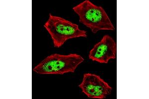 Fluorescent image of  cells stained with IL18 Antibody (C-term) . (IL-18 抗体  (C-Term))