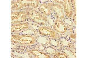 Immunohistochemistry of paraffin-embedded human kidney tissue using ABIN7163422 at dilution of 1:100 (ANKRD33 抗体  (AA 1-272))