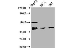 Western Blot Positive WB detected in: HepG2 whole cell lysate, U251 whole cell lysate, U87 whole cell lysate All lanes: TTF1 antibody at 1:2000 Secondary Goat polyclonal to rabbit IgG at 1/50000 dilution Predicted band size: 39 kDa Observed band size: 39 kDa (Recombinant NKX2-1 抗体)