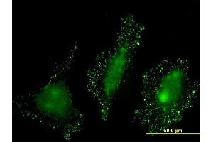 Immunofluorescence of monoclonal antibody to PKN2 on HeLa cell. (PKN2 抗体  (AA 580-679))